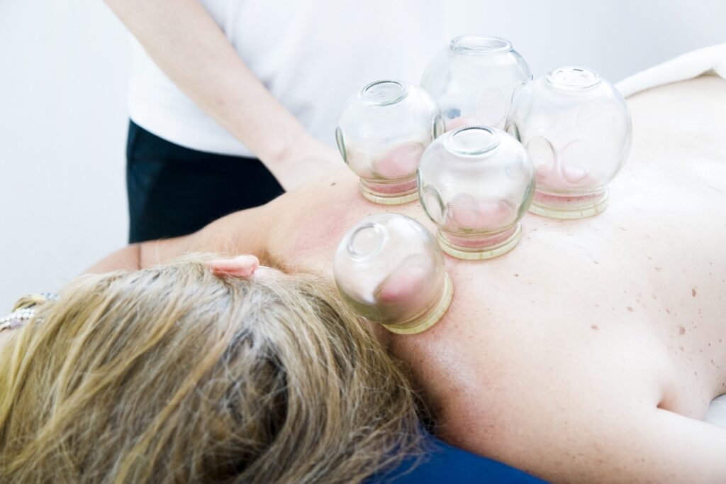 cupping-therapy-6604217_1280